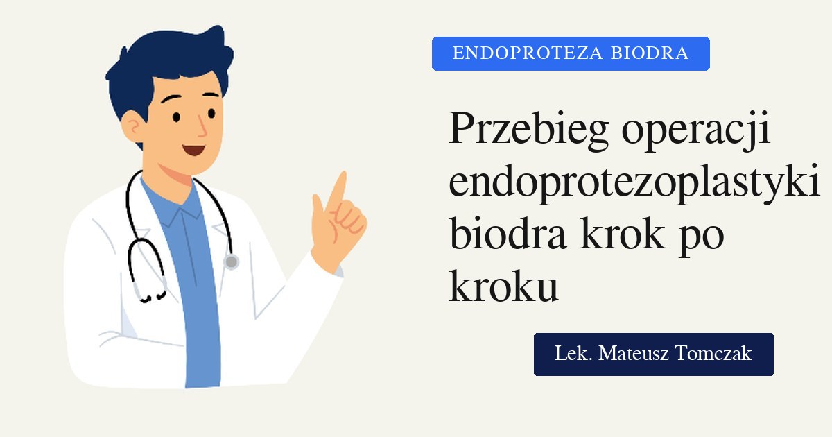 Przebieg operacji endoprotezoplastyki stawu biodrowego — krok po kroku (ze schematami)