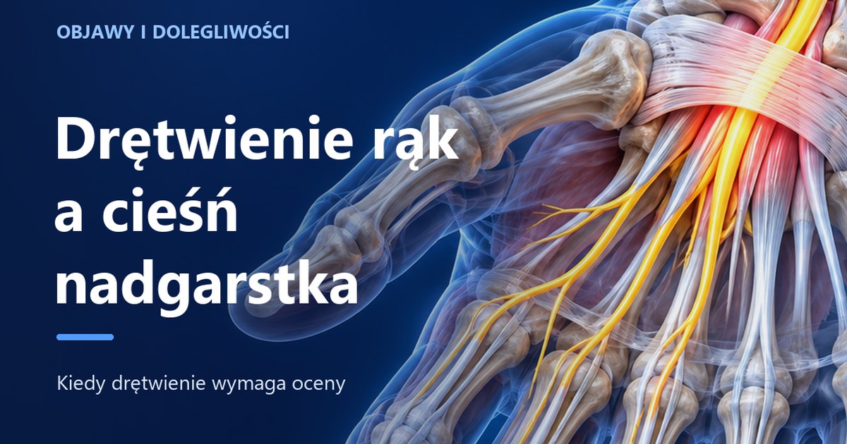 Drętwienie rąk a zespół cieśni nadgarstka