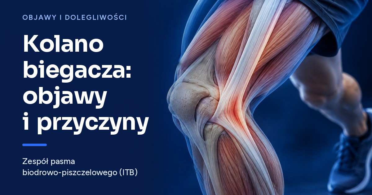 Zespół pasma biodrowo-piszczelowego (kolano biegacza) — co to jest, objawy i przyczyny